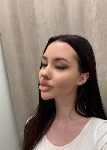 Лисса, Г. Борзя